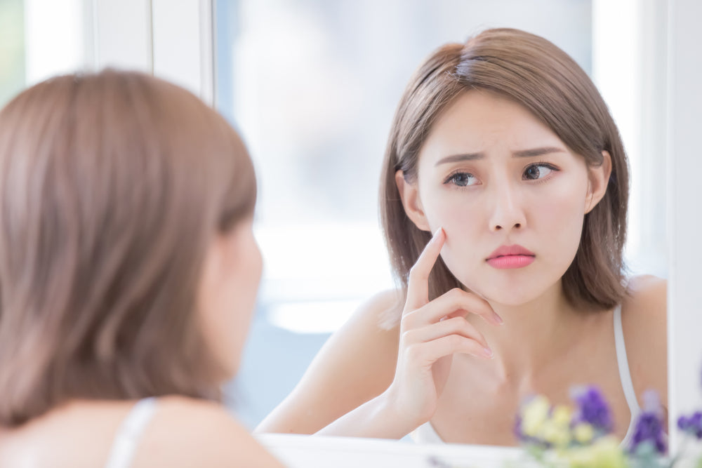 blackheads-vs-whiteheads-whats-the-difference
