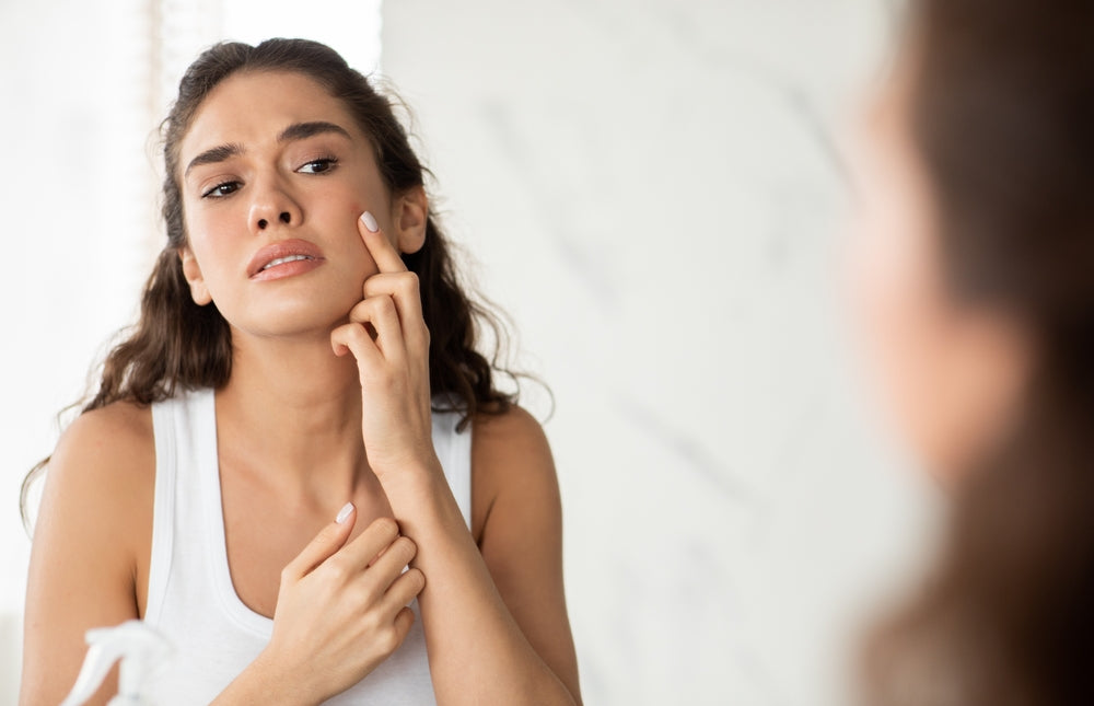 Cheek acne and how to reduce it