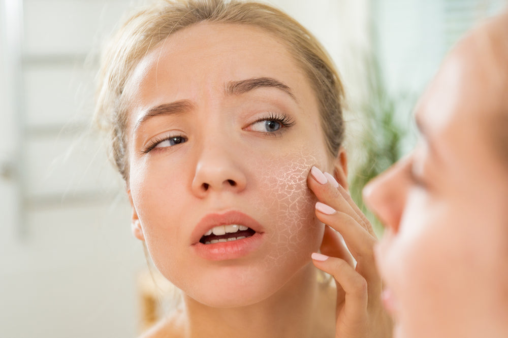 dry flaky skin on the face