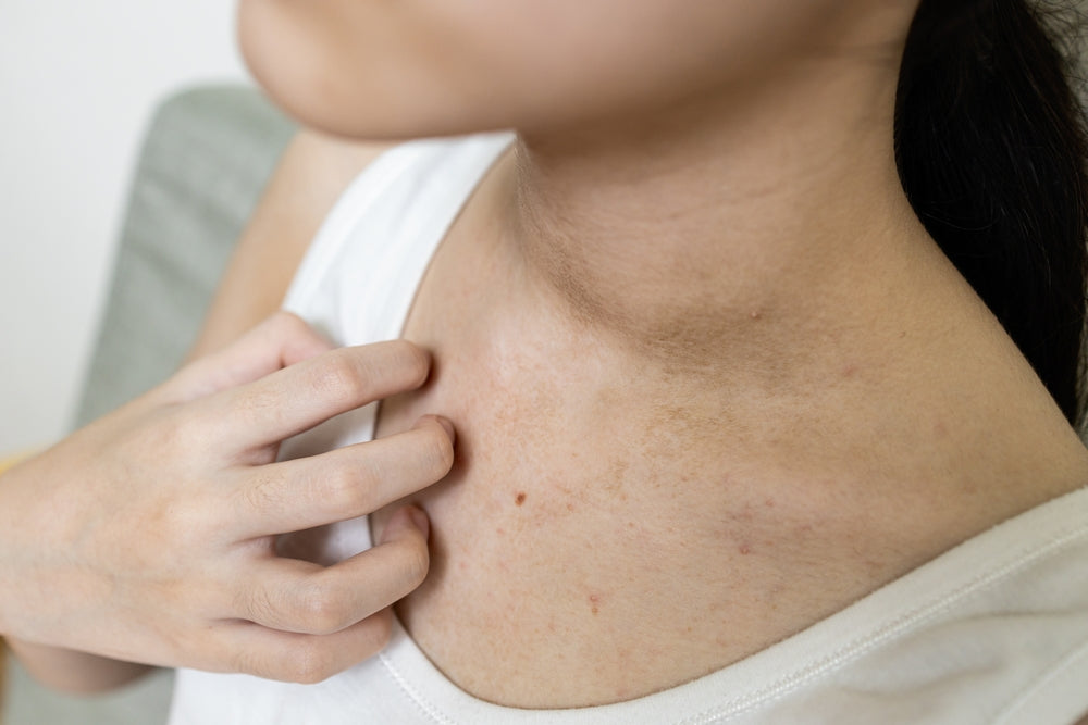How To Get Rid Of Chest Acne From Home Quickly