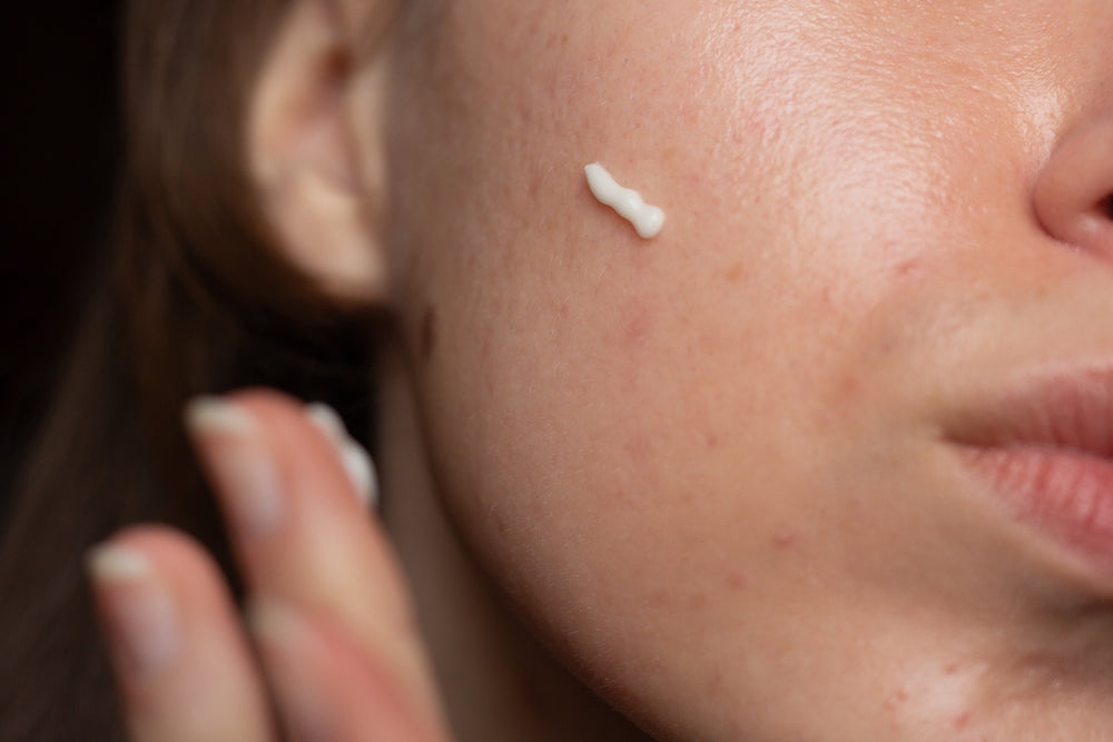 retinol-vs-retinoid-benefits